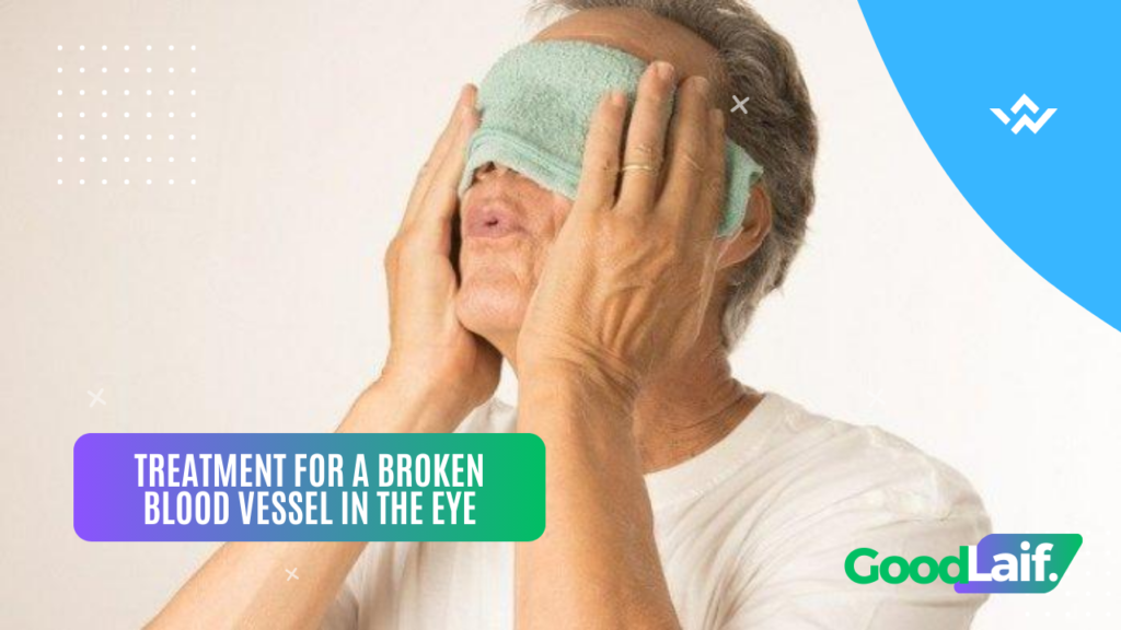 Treatment for a Broken Blood Vessel in the Eye