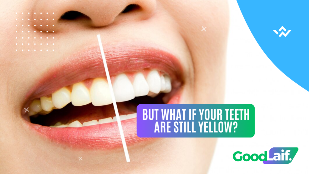 But What If Your Teeth Are Still Yellow? Here's the Solution: