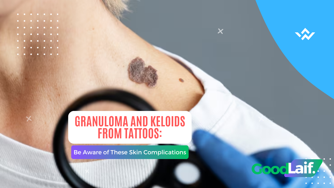 Granuloma and Keloids from Tattoos: Skin Complications