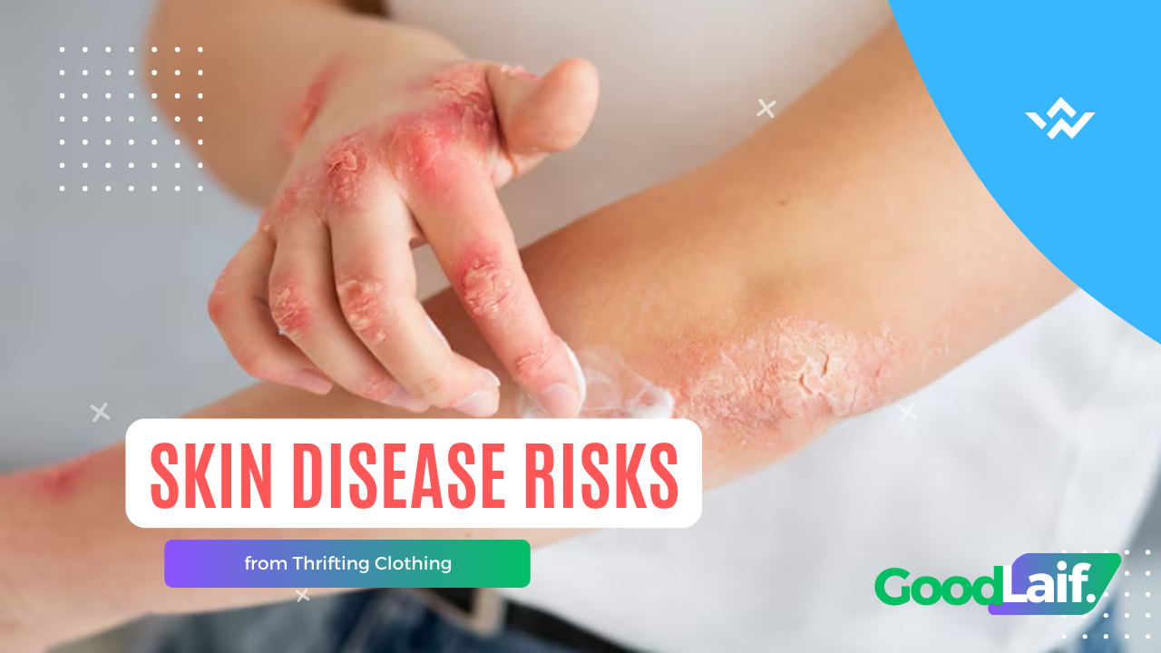 Skin Disease Risks from Thrifting Clothing: Myth or Fact?