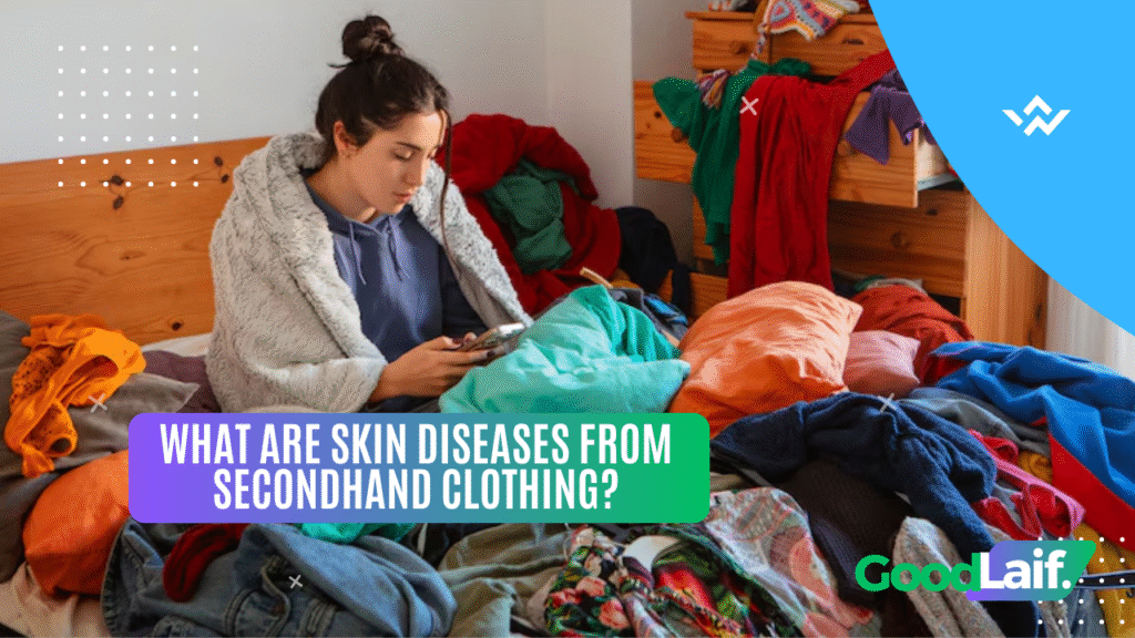What Are Skin Diseases from Secondhand Clothing?