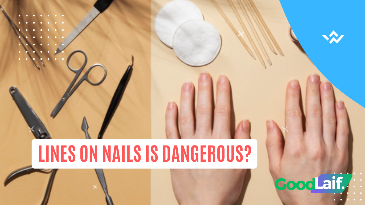 Lines on Nails Is Dangerous?