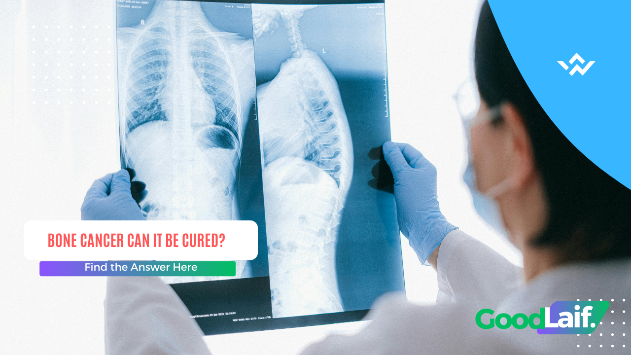 Bone Cancer Can It Be Cured