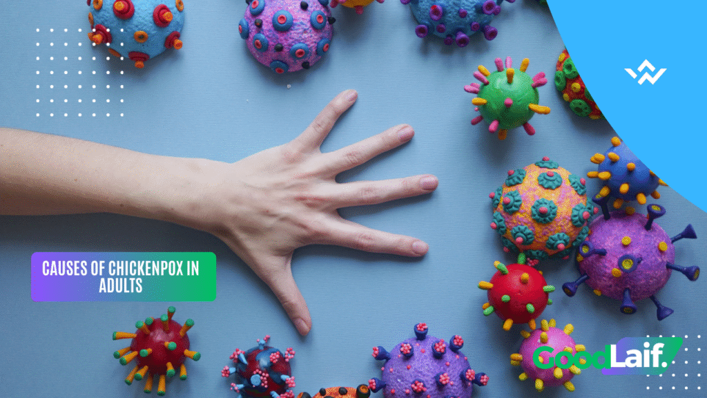 Reasons for Adult Chickenpox