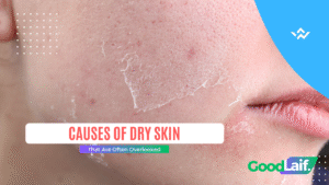 Causes of Dry Skin
