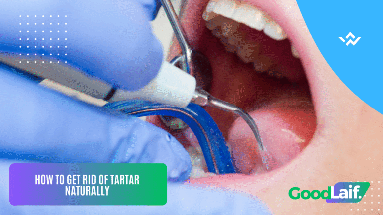 How to Get Rid of Tartar Naturally