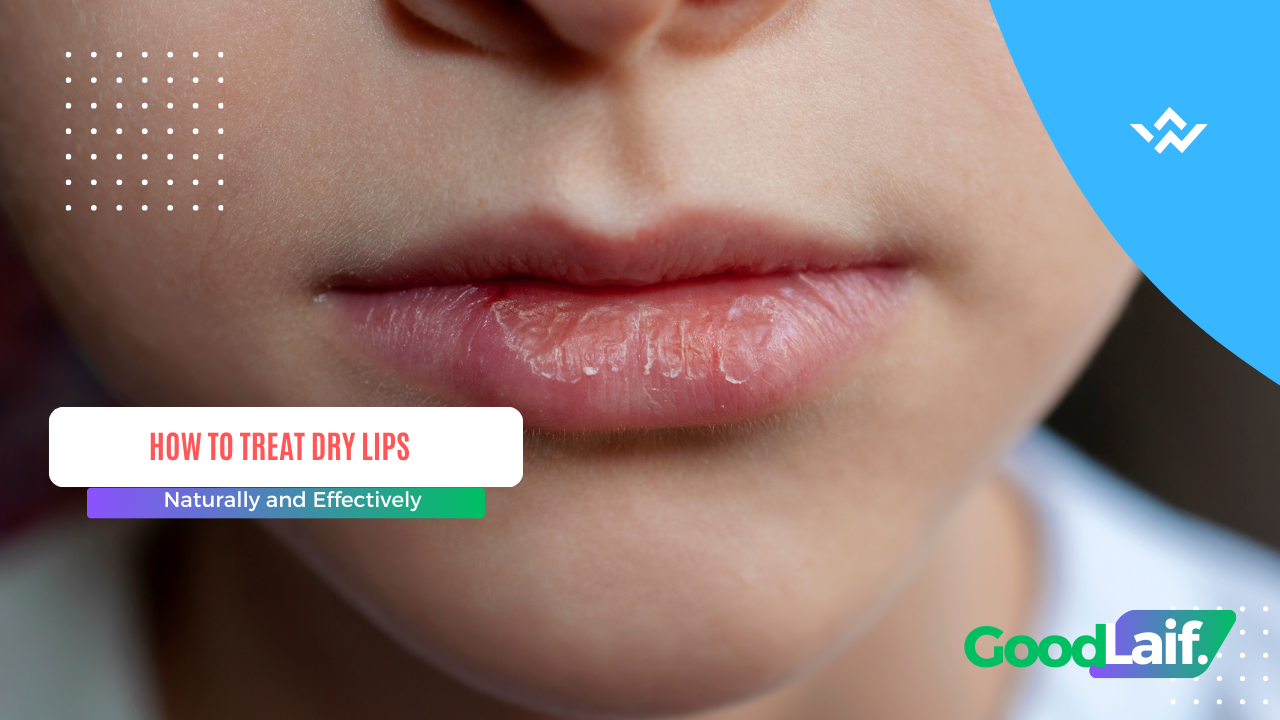 How to Treat Dry Lips
