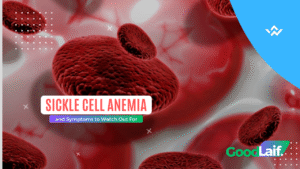 Sickle Cell Anemia and Symptoms to Watch Out For