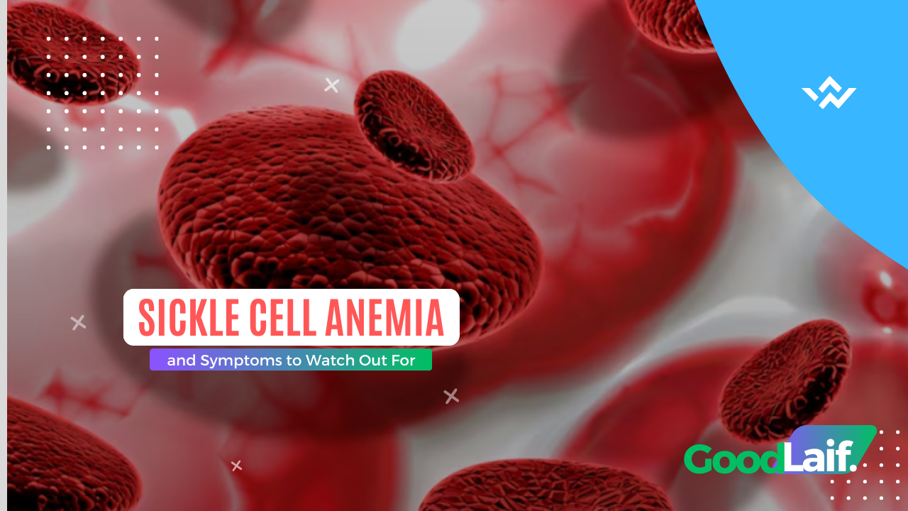 Sickle Cell Anemia and Symptoms to Watch Out For