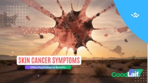 Skin Cancer Symptoms Caused by Sun Exposure