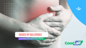 Causes of Gallstones and How to Overcome Them