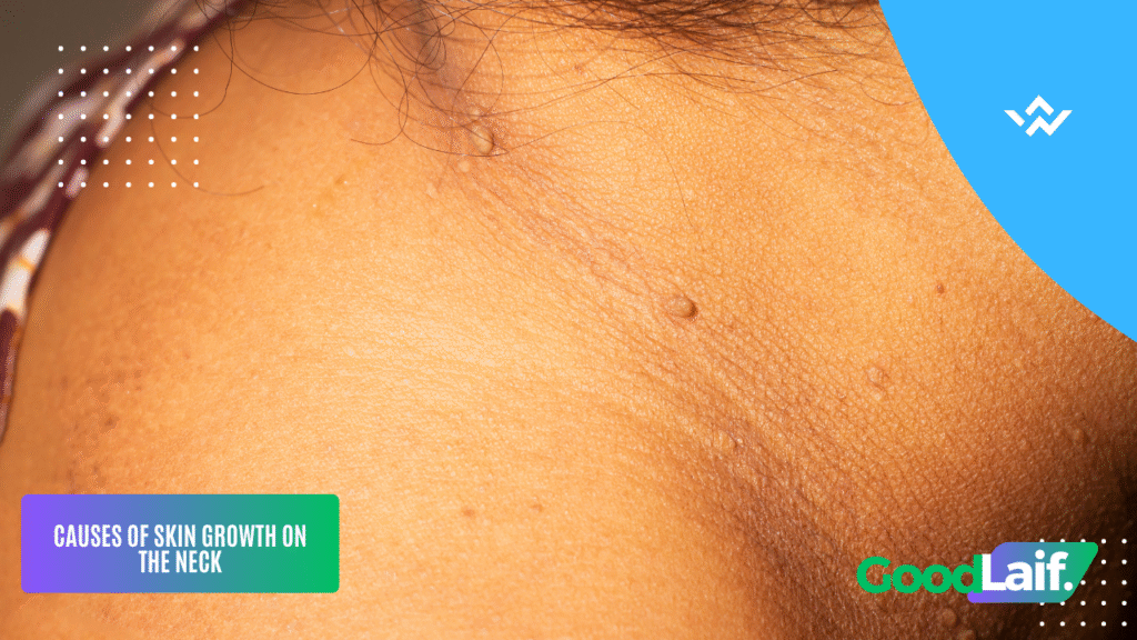 Neck Skin Growth