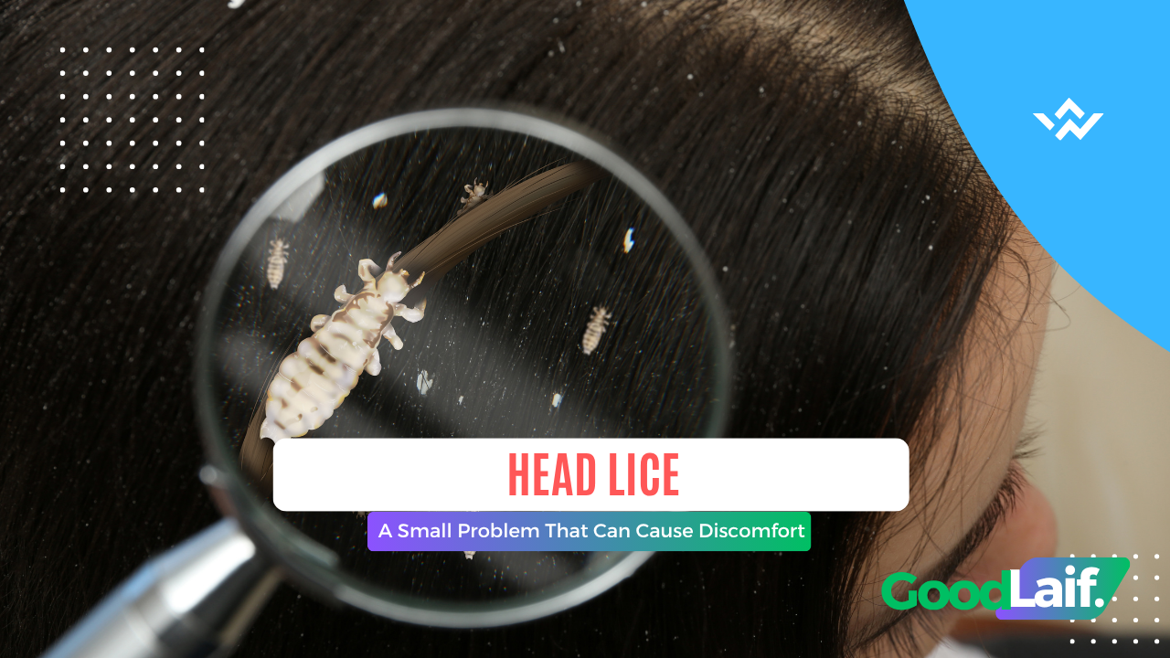Head Lice