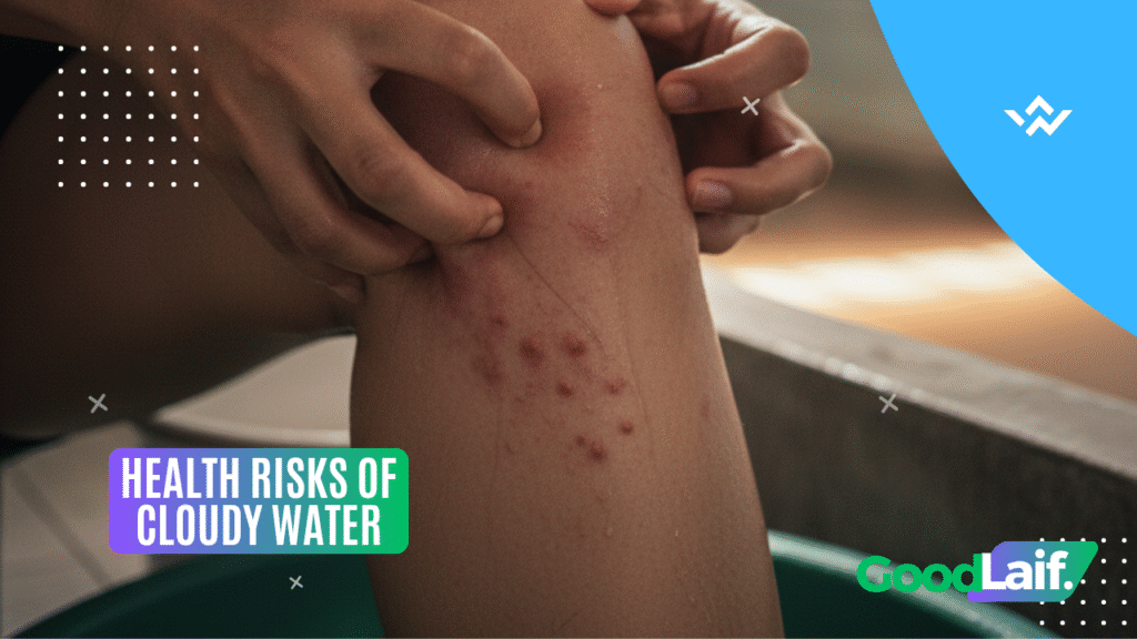 Health Risks of Cloudy Water