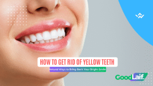 How to Get Rid of Yellow Teeth