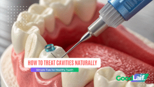 How to Treat Cavities