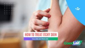 How to Treat Itchy Skin