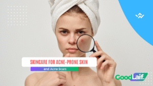 Skincare for Acne-Prone Skin and Acne Scars