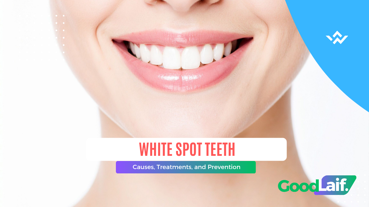 White Spot Teeth