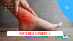How to Reduce Swelling in the Legs