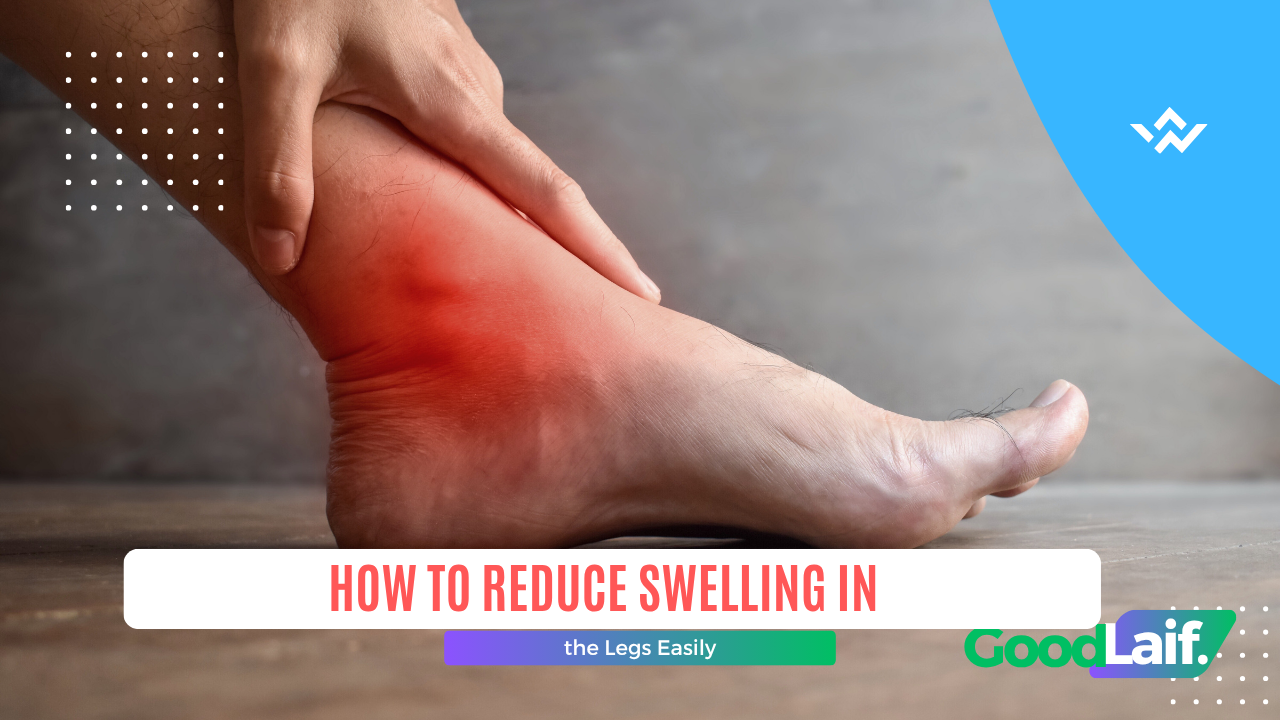 How to Reduce Swelling in the Legs