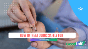 How to Treat Corns