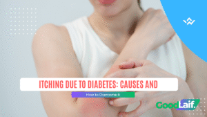 Itching Due to Diabetes
