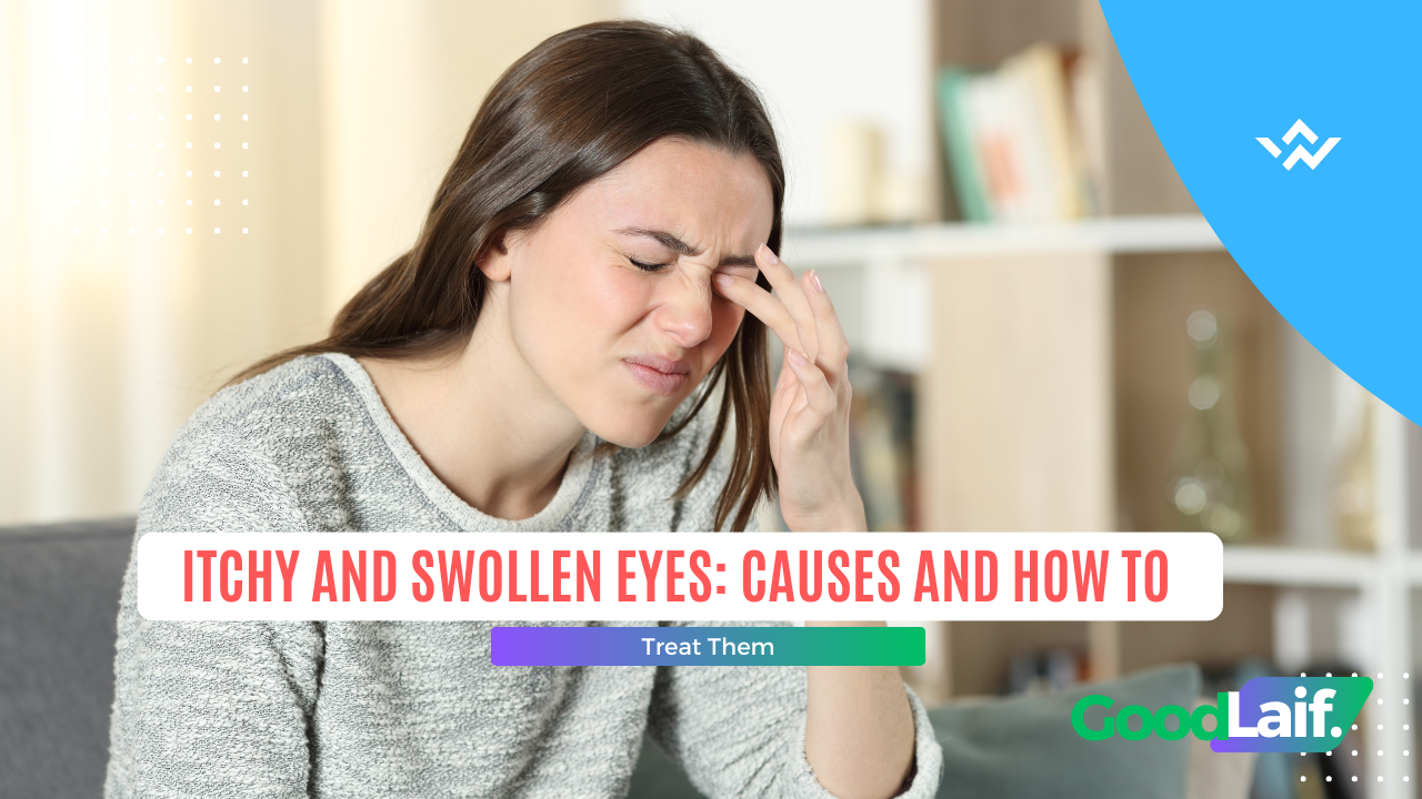 Itchy and Swollen Eyes