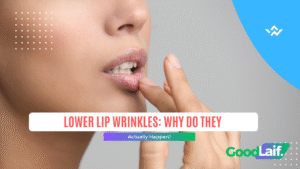 Lower Lip Wrinkles