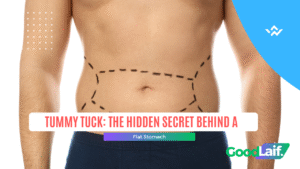 Tummy Tuck