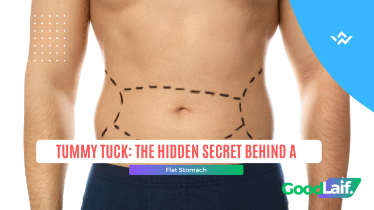 Tummy Tuck: The Hidden Secret Behind a Flat Stomach