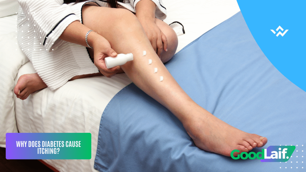 Itching Due to Diabetes