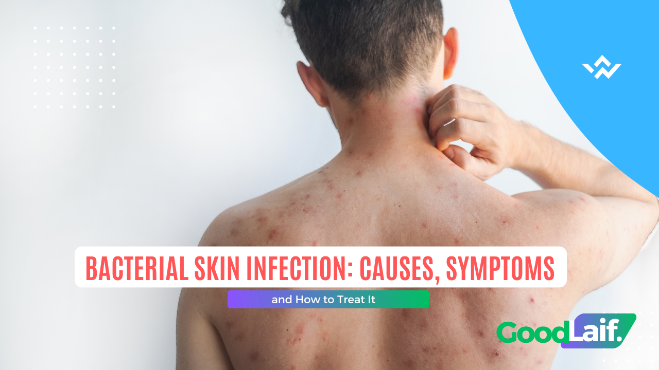 Bacterial Skin Infection