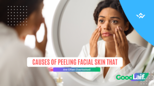 Causes of Peeling Facial Skin