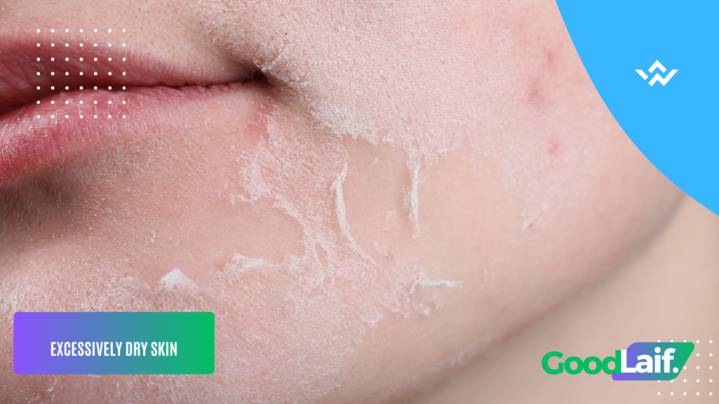 Causes of Peeling Facial Skin