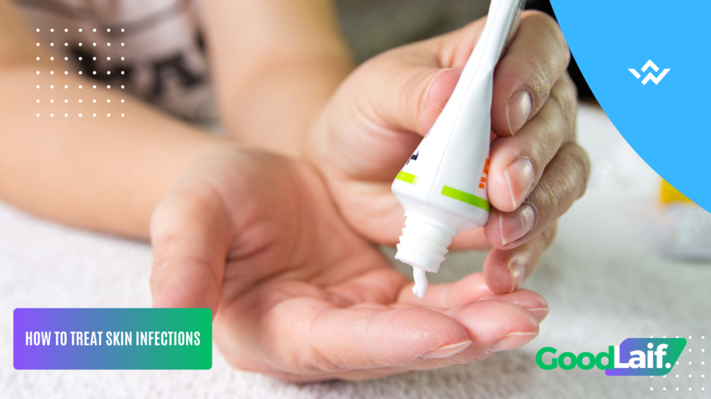 Bacterial Skin Infection