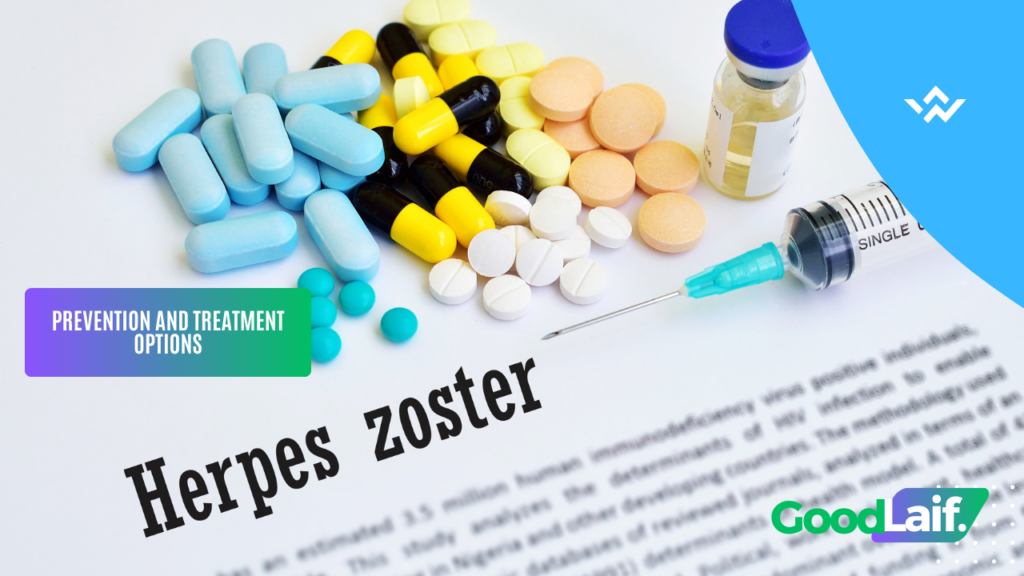 Herpes Zoster