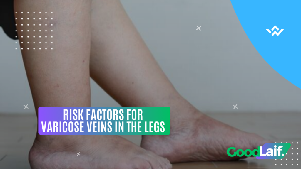 Risk Factors for Varicose Veins in the Legs