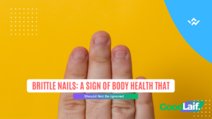 Brittle Nails