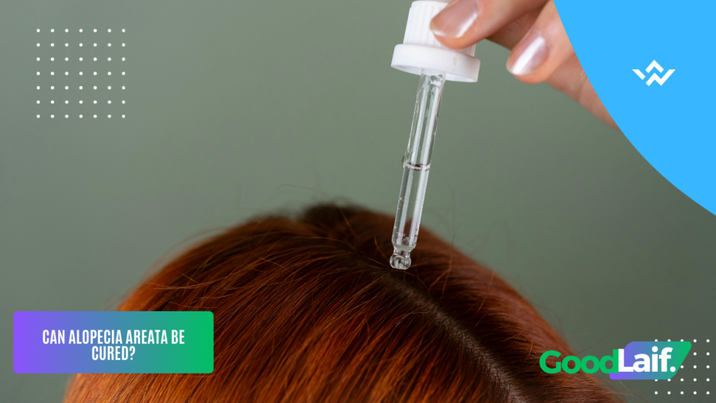 Causes of Alopecia Areata