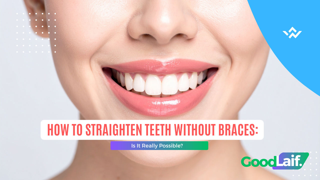 How to Straighten Teeth Without Braces