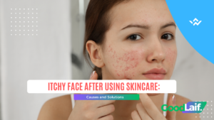 Itchy Face After Using Skincare