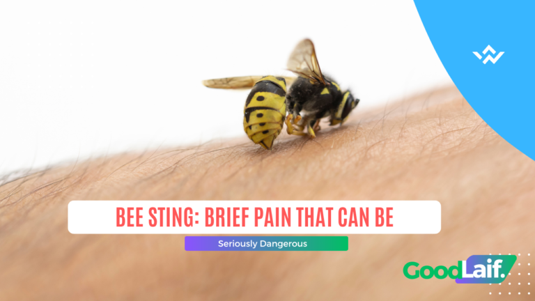 Bee Sting: Brief Pain That Can Be Seriously Dangerous