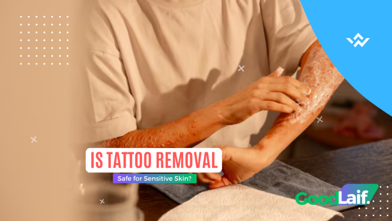 Is Tattoo Removal Safe for Sensitive Skin?