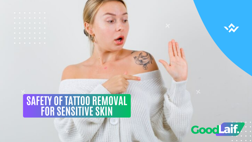 Safety of Tattoo Removal for Sensitive Skin