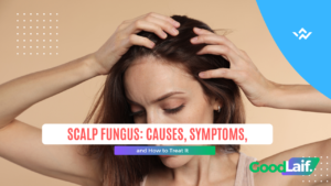 Scalp Fungus