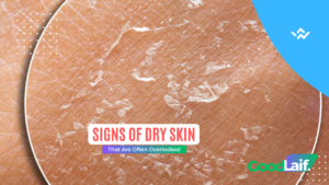 Signs of Dry Skin That Are Often Overlooked