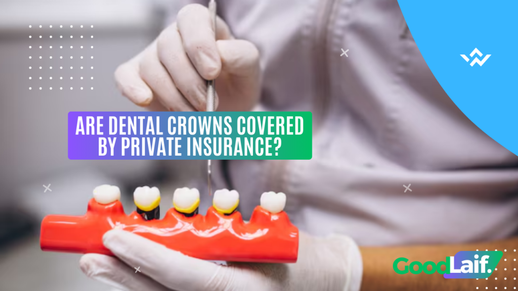 Are Dental Crowns Covered by Private Insurance?