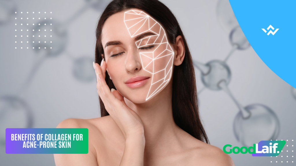 Benefits of Collagen for Acne-Prone Skin
