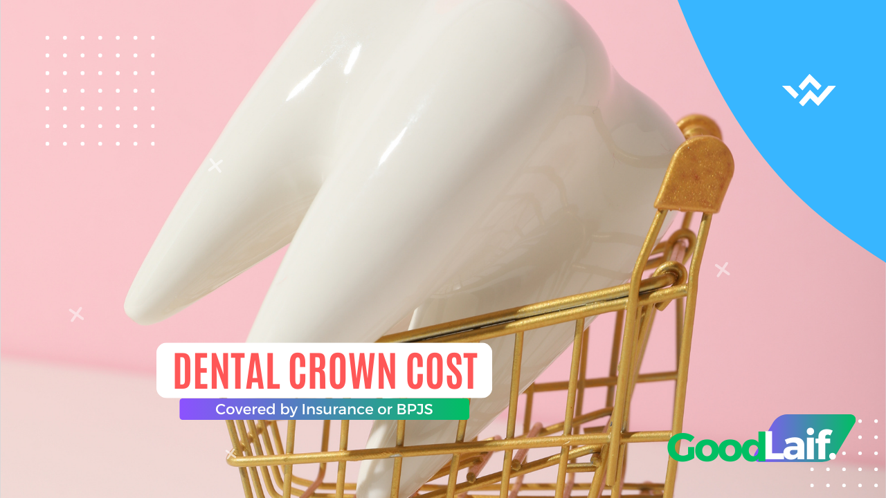 Dental Crown Cost Covered by Insurance or BPJS